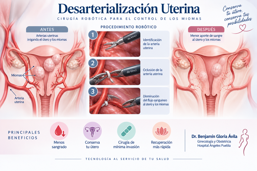 Desarterialización uterina desarterialización uterina imagen dr benjamin gloria