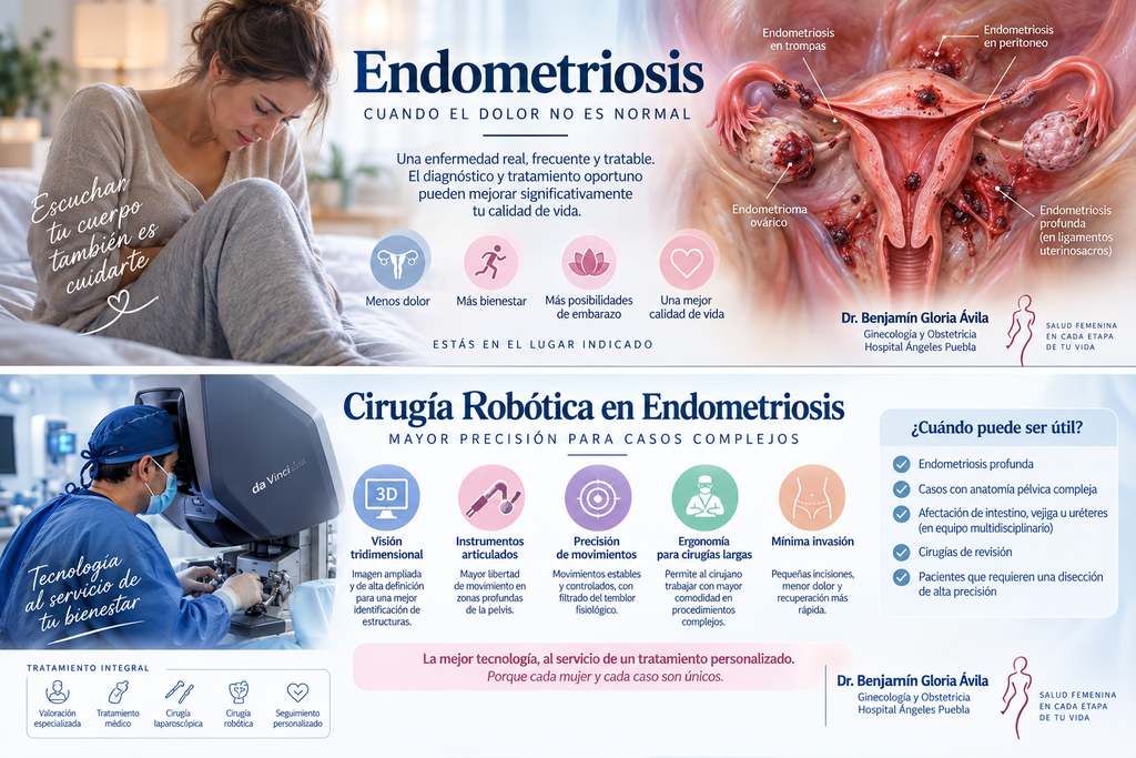 endometriosis puebla