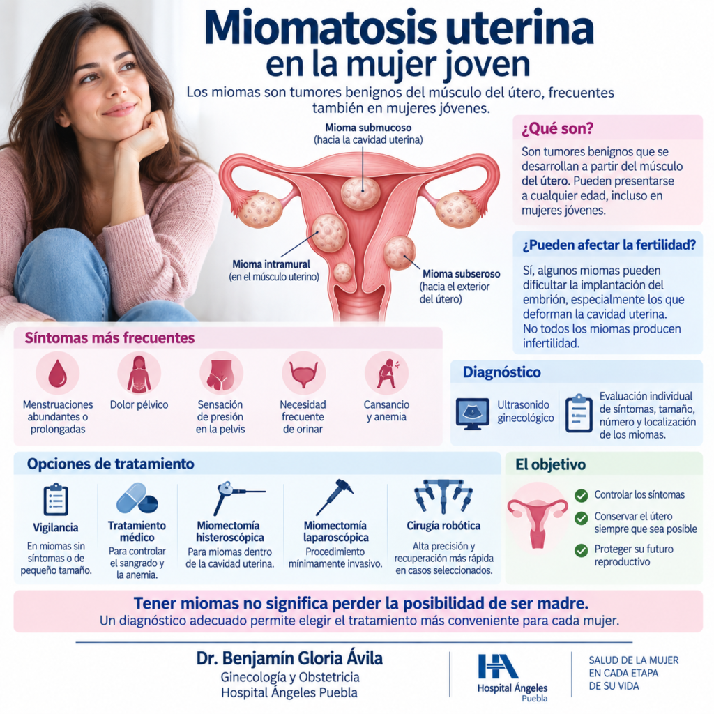 Miomatosis uterina miomatosis uterina en la mujer joven dr benjamin gloria