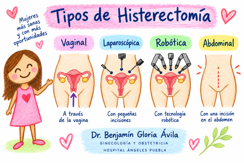 Infografía sobre diferentes vías quirúrgicas de histerectomía.