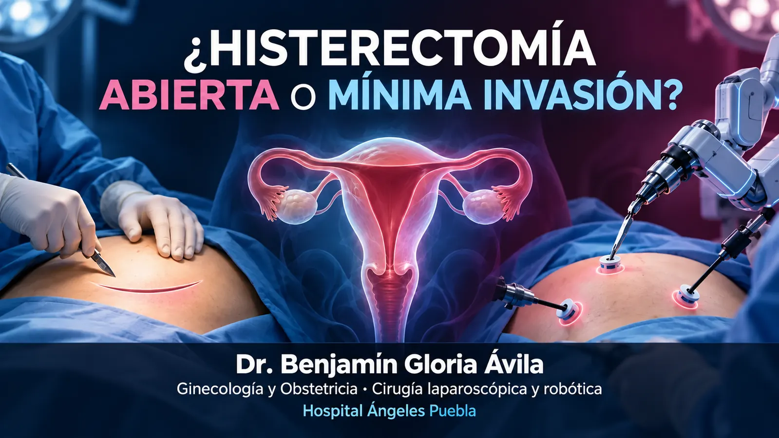 Ilustración comparativa de histerectomía abierta y técnicas de mínima invasión.